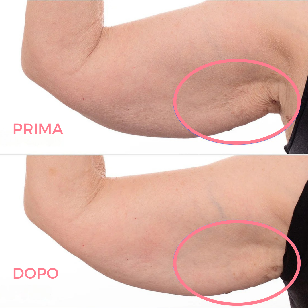 Crema Rassodante e Tonificante per le Braccia