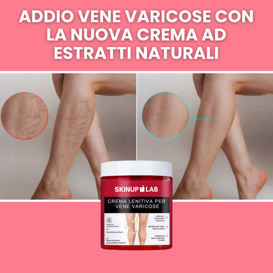 Crema gambe per eliminare definitivamente le vene varicose (80g)